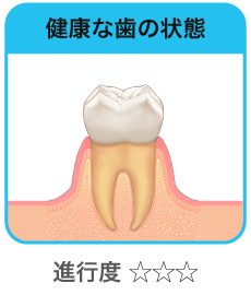 健康な歯の状態
